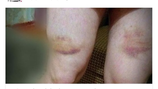 xvWFjIJTajhGWGv-556x313-cropped